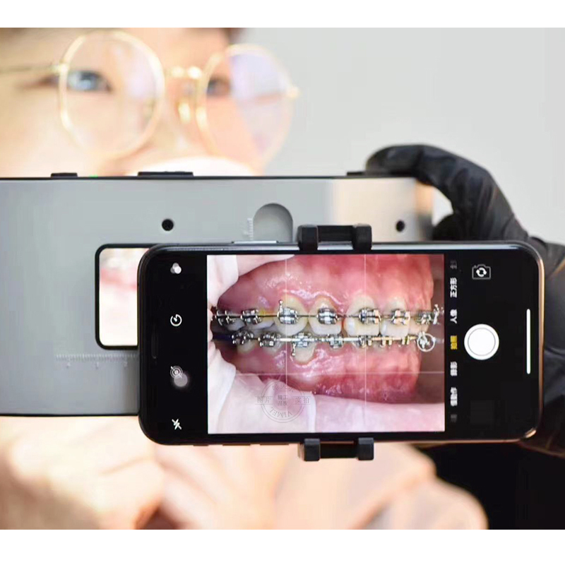 Nuova Lampada Flash Dentale co - Photography Lighting With Flash recensione e prezzo
